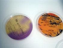 Analyses bactériologiques des gaines textiles