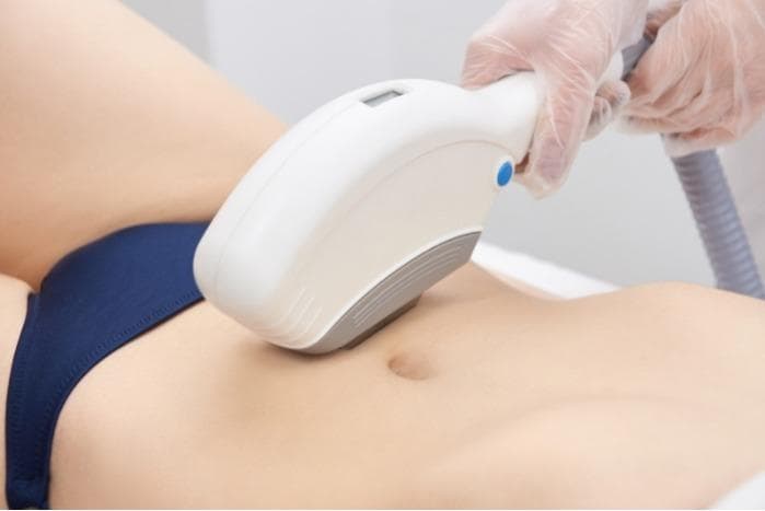 Laser Hair Removal