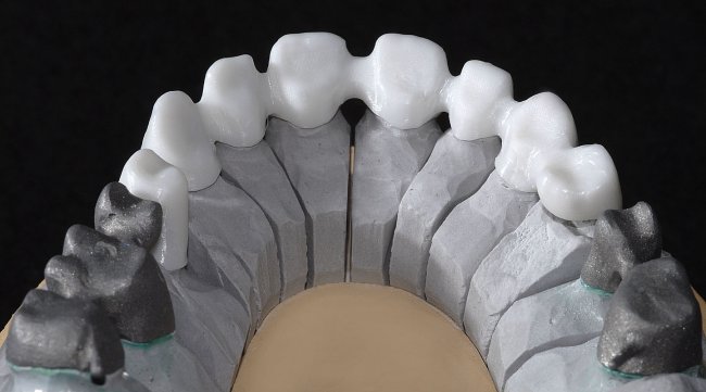 Dentalprothesen