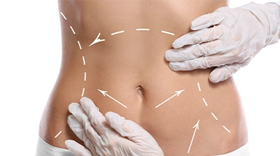 Liposuction | Fazla yaglarinizdan kurtulun